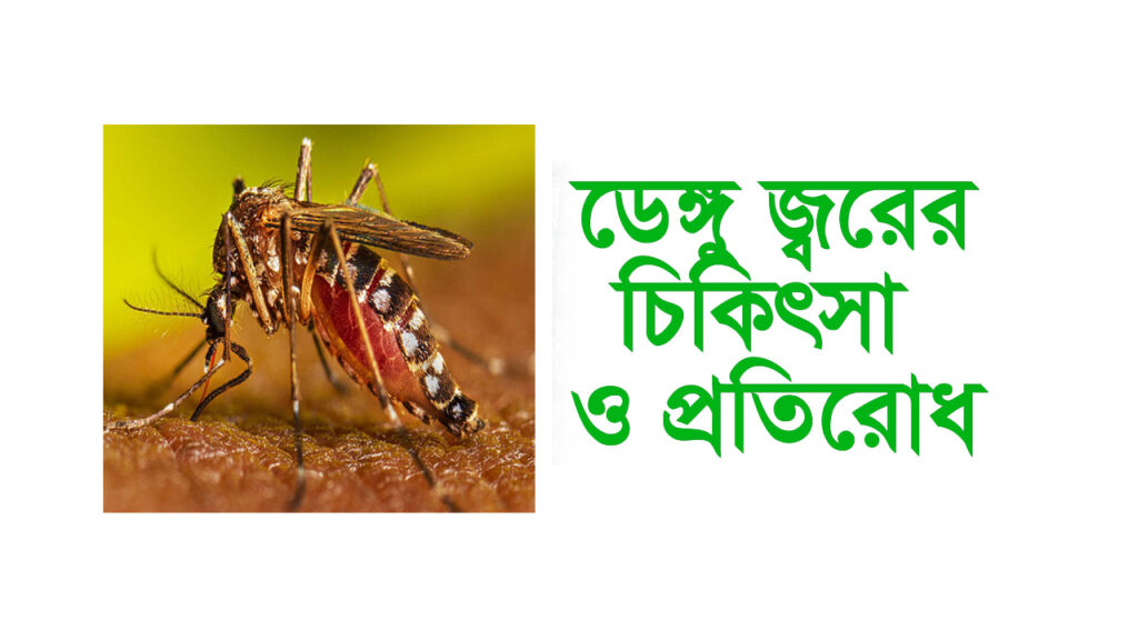 ডেঙ্গু জ্বর হলে করণীয় ও সঠিক চিকিৎসা ২০২৪